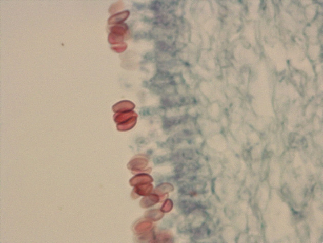 Coprinus Slides - Coprinus 04 400X